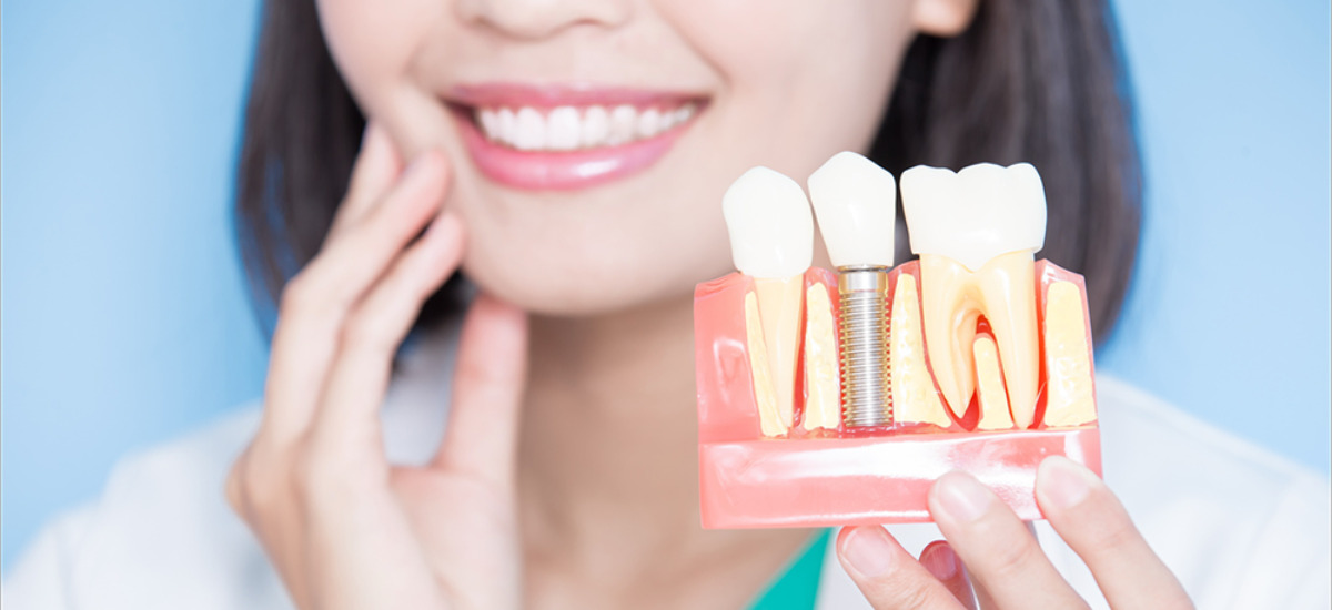 当院が目指すインプラント治療