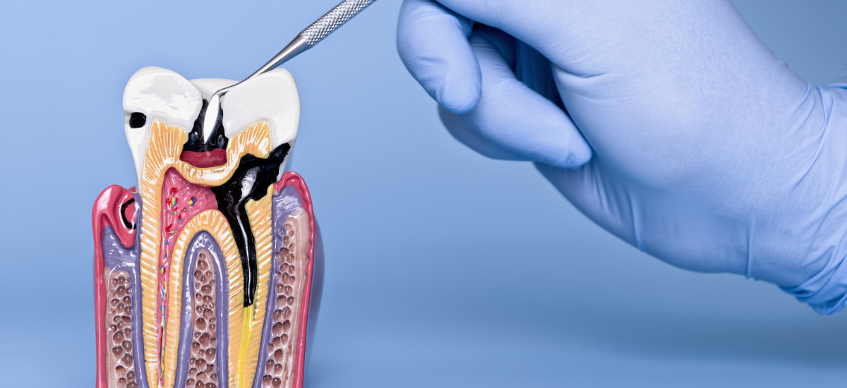 進行段階で変わる治療法