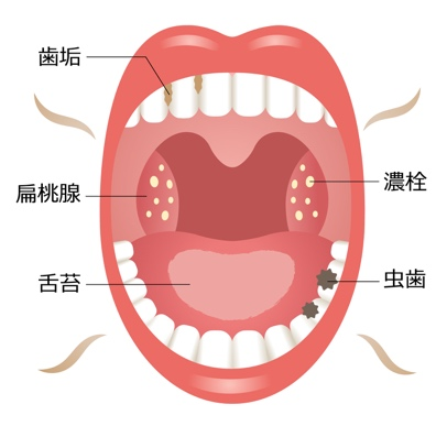 口臭の原因は“あなたのせい”ではありません