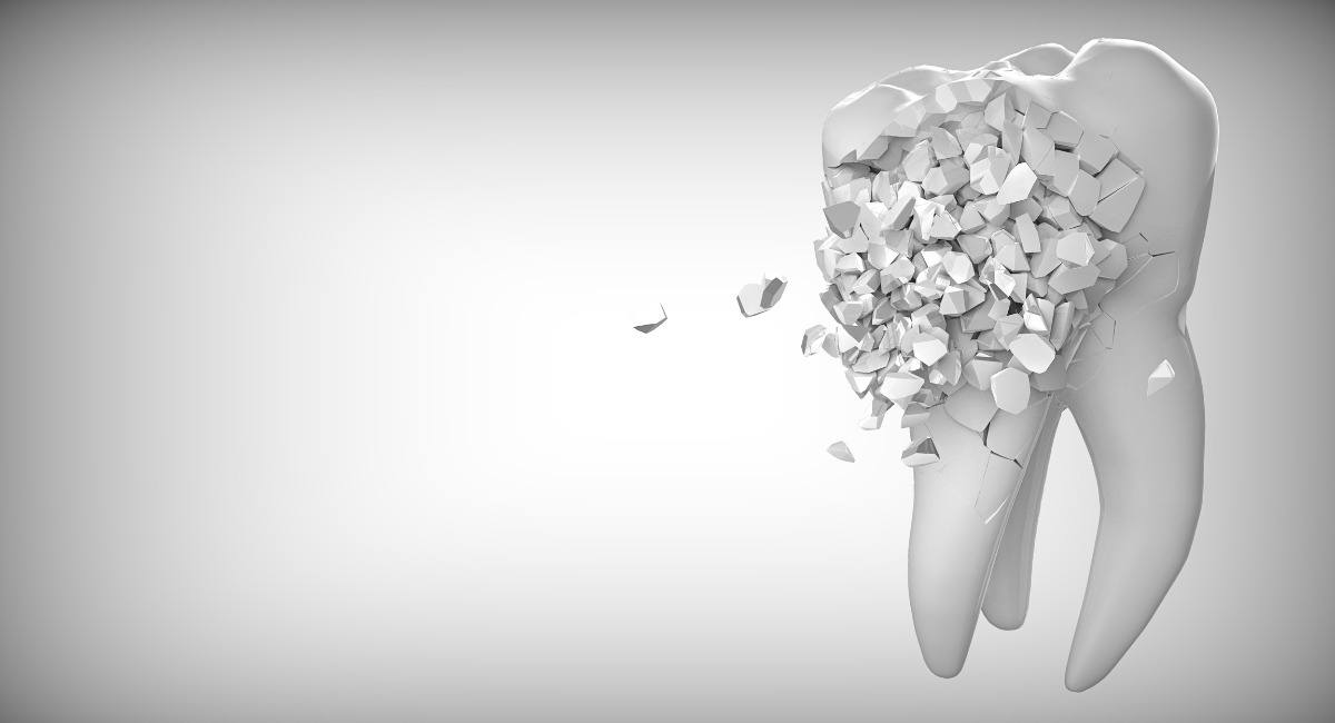 なぜ歯はここまで悪化してしまうのか