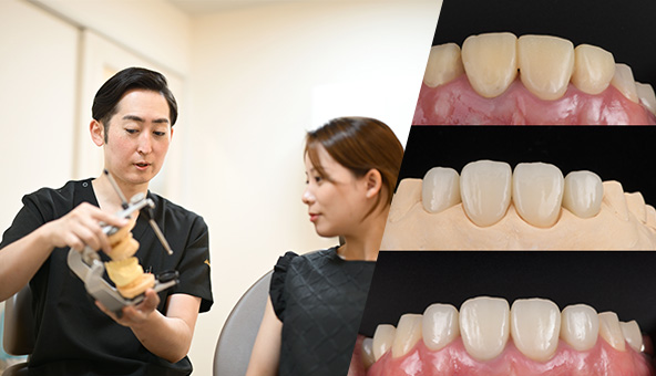 美しさとかみ合わせの両立